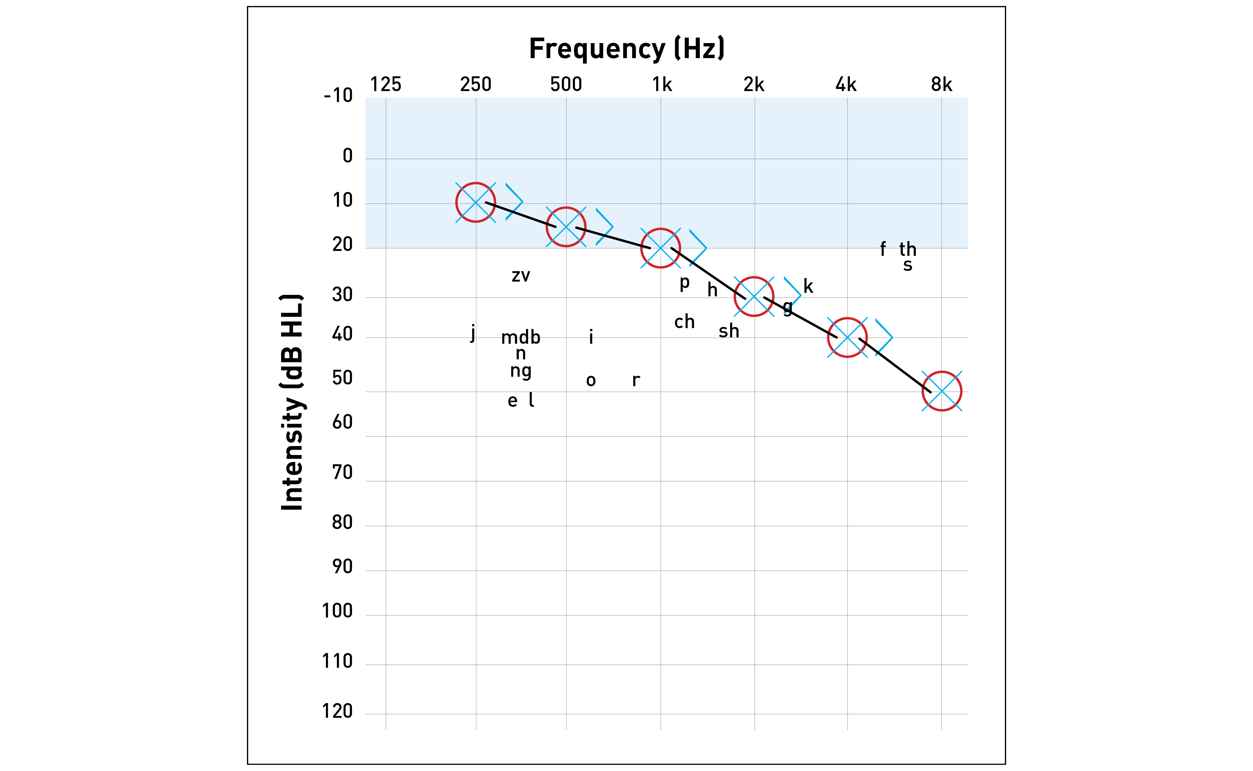 A Simple Guide To Understanding An Audiogram